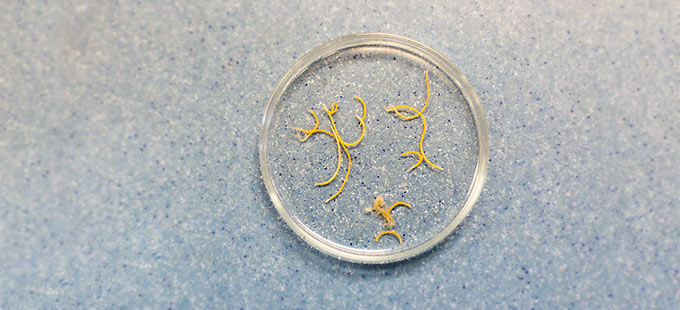 ascariasis spulwurm hundewurm